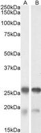 TPPP antibody, GTX88044, GeneTex, Western Blot image 