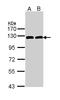 ATP Citrate Lyase antibody, LS-C109477, Lifespan Biosciences, Western Blot image 