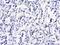 Suppressor Of Cytokine Signaling 1 antibody, NB100-781, Novus Biologicals, Immunohistochemistry paraffin image 