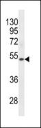 Keratin 72 antibody, 60-728, ProSci, Western Blot image 