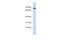 Coiled-Coil Domain Containing 151 antibody, A12348, Boster Biological Technology, Western Blot image 