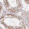 CLK4 Associating Serine/Arginine Rich Protein antibody, NBP2-32548, Novus Biologicals, Immunohistochemistry paraffin image 