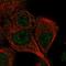 Calcium/Calmodulin Dependent Protein Kinase II Delta antibody, NBP1-88211, Novus Biologicals, Immunocytochemistry image 