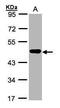 Mitogen-Activated Protein Kinase Kinase 2 antibody, GTX102198, GeneTex, Western Blot image 