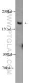 WRN RecQ Like Helicase antibody, 25269-1-AP, Proteintech Group, Western Blot image 