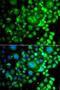 Sorting Nexin 3 antibody, LS-C349194, Lifespan Biosciences, Immunofluorescence image 