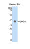 Cyclin Dependent Kinase 7 antibody, LS-C293591, Lifespan Biosciences, Western Blot image 