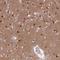 LysM Domain Containing 2 antibody, HPA040460, Atlas Antibodies, Immunohistochemistry paraffin image 