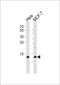 Ring-Box 1 antibody, 61-030, ProSci, Western Blot image 
