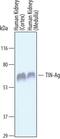 Tubulointerstitial Nephritis Antigen antibody, AF6797, R&D Systems, Western Blot image 