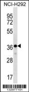 THAP Domain Containing 8 antibody, 56-922, ProSci, Western Blot image 