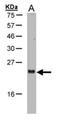 ADP Ribosylation Factor Like GTPase 2 antibody, orb89366, Biorbyt, Western Blot image 