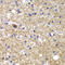 Cyclin Dependent Kinase 6 antibody, LS-C746746, Lifespan Biosciences, Immunohistochemistry paraffin image 