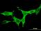 Doublecortin Like Kinase 1 antibody, H00009201-M03, Novus Biologicals, Immunofluorescence image 