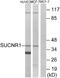 Succinate Receptor 1 antibody, A08485, Boster Biological Technology, Western Blot image 