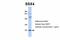 SSX Family Member 4B antibody, A15747, Boster Biological Technology, Western Blot image 