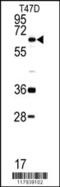 DEAD-Box Helicase 5 antibody, 62-930, ProSci, Western Blot image 