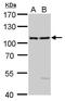 Exocyst Complex Component 2 antibody, GTX120818, GeneTex, Western Blot image 