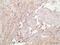 ADAM Metallopeptidase With Thrombospondin Type 1 Motif 1 antibody, ab39194, Abcam, Immunohistochemistry paraffin image 