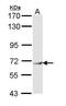 Interferon Induced Protein With Tetratricopeptide Repeats 3 antibody, GTX112593, GeneTex, Western Blot image 