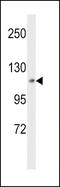 Mitogen-Activated Protein Kinase Kinase Kinase Kinase 3 antibody, 64-153, ProSci, Western Blot image 
