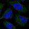 Centromere Protein M antibody, NBP2-34079, Novus Biologicals, Immunofluorescence image 