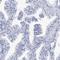 Spermatogenesis Associated 7 antibody, HPA038082, Atlas Antibodies, Immunohistochemistry frozen image 