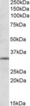 Glutamate Metabotropic Receptor 2 antibody, LS-B8336, Lifespan Biosciences, Western Blot image 