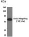 Sonic Hedgehog Signaling Molecule antibody, GTX52693, GeneTex, Western Blot image 