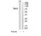 T-Box 3 antibody, TA314600, Origene, Western Blot image 