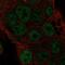 Torsin-4A antibody, PA5-60865, Invitrogen Antibodies, Immunofluorescence image 