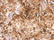 Cerebellar Degeneration Related Protein 2 antibody, GTX129122, GeneTex, Immunohistochemistry paraffin image 