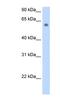 Solute Carrier Family 1 Member 4 antibody, NBP1-60038, Novus Biologicals, Western Blot image 