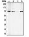 Ribosomal Protein S6 Kinase B1 antibody, orb214540, Biorbyt, Western Blot image 