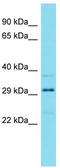 HEAT Repeat Containing 3 antibody, TA337339, Origene, Western Blot image 