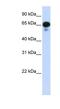 Protein Phosphatase, Mg2+/Mn2+ Dependent 1J antibody, NBP1-56574, Novus Biologicals, Western Blot image 