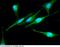 Mitogen-Activated Protein Kinase 9 antibody, 10745-MM06, Sino Biological, Immunohistochemistry paraffin image 