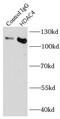 Histone Deacetylase 4 antibody, FNab03801, FineTest, Immunoprecipitation image 