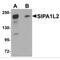 Signal Induced Proliferation Associated 1 Like 2 antibody, MBS150183, MyBioSource, Western Blot image 