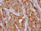 Insulin Like Growth Factor Binding Protein 2 antibody, CSB-RA225697A0HU, Cusabio, Immunohistochemistry frozen image 