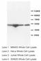 Endothelin B receptor antibody, LS-C171558, Lifespan Biosciences, Western Blot image 