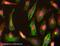 Myosin Heavy Chain 10 antibody, ab684, Abcam, Immunofluorescence image 