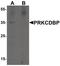 Caveolae Associated Protein 3 antibody, PA5-34523, Invitrogen Antibodies, Western Blot image 