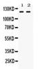 LIG3 antibody, PB10077, Boster Biological Technology, Western Blot image 