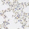 Ribosomal Protein S6 Kinase A3 antibody, LS-C346084, Lifespan Biosciences, Immunohistochemistry paraffin image 