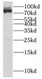 A-Kinase Anchoring Protein 17A antibody, FNab07789, FineTest, Western Blot image 