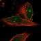 SMG6 Nonsense Mediated MRNA Decay Factor antibody, NBP1-92410, Novus Biologicals, Immunocytochemistry image 