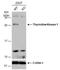 Thymidine Kinase 1 antibody, NBP2-20626, Novus Biologicals, Western Blot image 