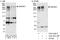 Ankyrin Repeat And KH Domain Containing 1 antibody, A303-306A, Bethyl Labs, Immunoprecipitation image 