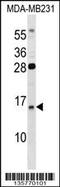 Guanylate Cyclase Activator 2B antibody, 58-458, ProSci, Western Blot image 